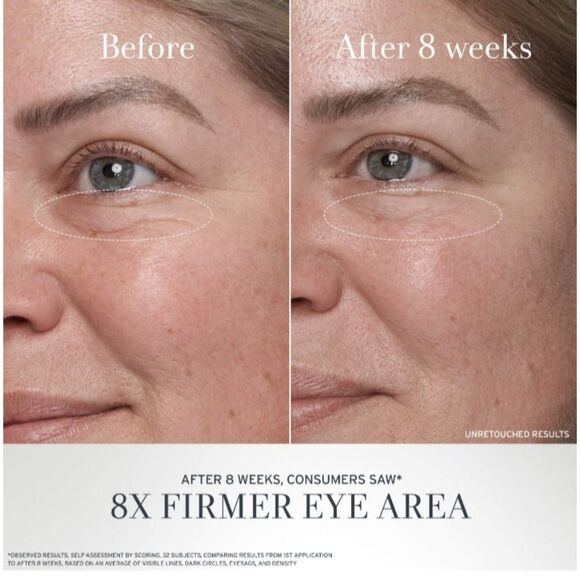 FRESH Black Tea Advanced Age Renewal Anti-Aging Eye Cream - Picture 2 of 8